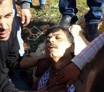 لحظة الإصابة