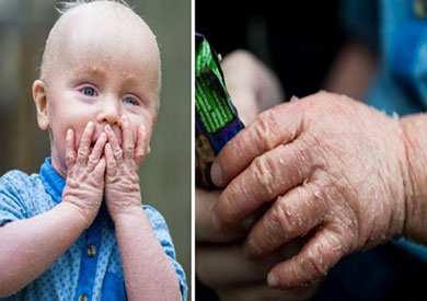 صورة الطفل المريض